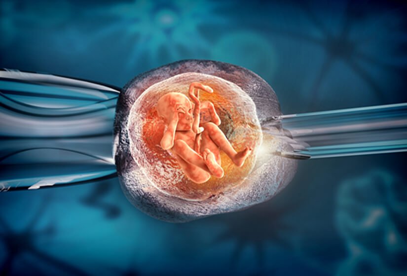 Best IVF Center in Jaipur